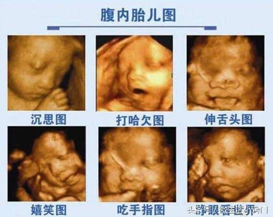 孕检时的各种问题,孕检三大注意事项