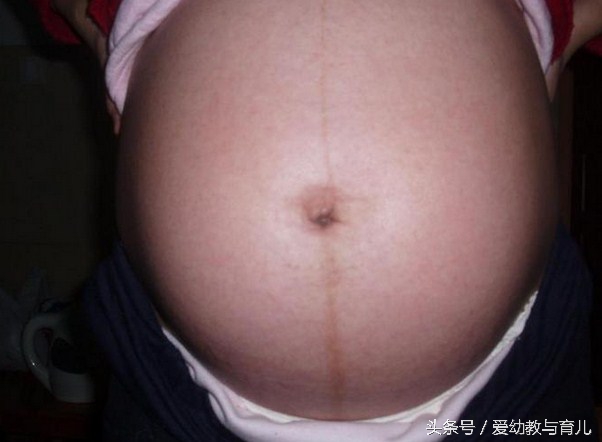 怀孕期间双方查出地贫可以治愈吗,孕妇查出地贫基因3.7缺失杂合子