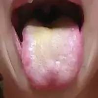 身体最健康舌头是怎么样的,健康人是什么体质