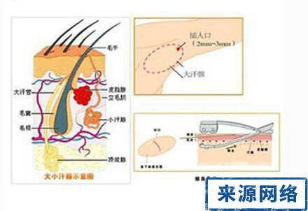 腋窝下的异味怎么来的,产后腋窝下有难闻的气味