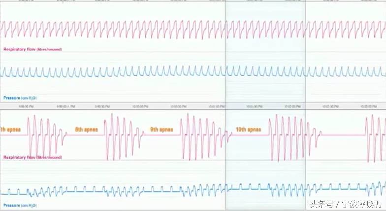 瑞思迈s9autoset-s的价格,瑞思迈s9autoset-s评测