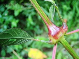 风湿骨痛腰膝酸软吃什么药,风湿性关节腰膝酸痛怎么治疗