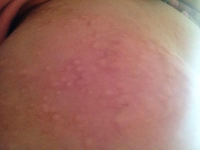 完美芦荟胶功用,你知道芦荟胶的妙用吗