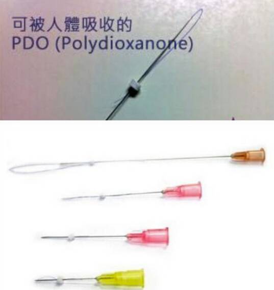 埋线隆鼻和假体隆鼻,鼻梁塌又不想做手术怎么办