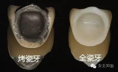 新美容|唇膏买嗨了,可你的牙配得上这些唇膏吗?