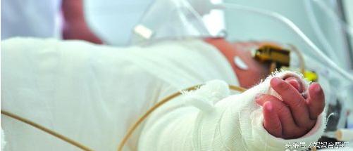 小孩被热粥烫伤大面积怎么处理,宝宝吃粥烫伤怎么处理