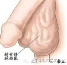 有小孩了还需要做精索静脉曲张吗,有小孩了重度精索静脉曲张