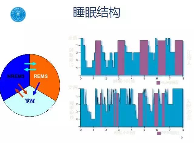 如何非药物治疗失眠？苏亮医师有妙招