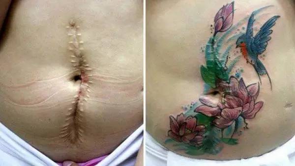 将疤痕变成灿烂花朵美女刺青师精心修复身体伤口