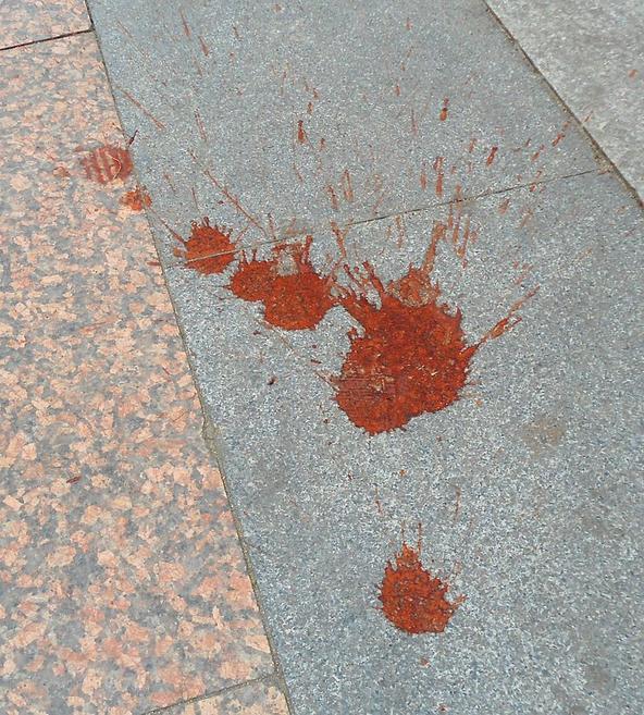 第一次吃槟榔喘不过气差点去世,第一次吃槟榔头晕嗓子肿