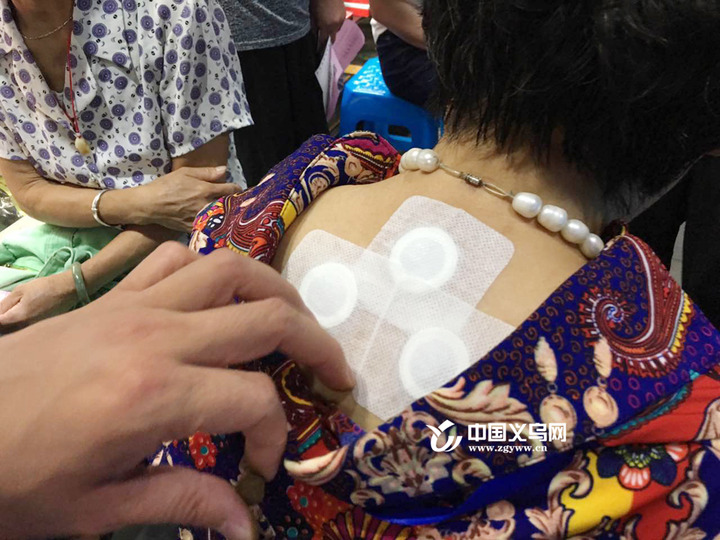 三伏贴三伏灸共治冬病,冬病夏治三伏贴事半功倍