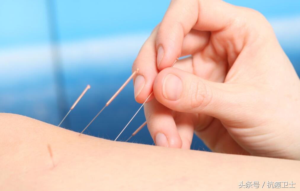 针灸推拿治疗癌症,癌症后期昏迷中医针灸