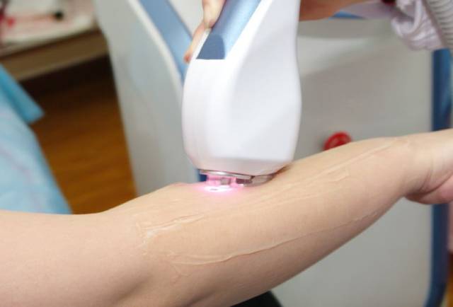 连志玲姐姐都苦恼的唇毛，你知道怎么办吗？