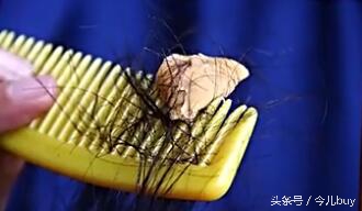 头发上粘了口香糖怎么快速去除,口香糖粘头发上怎么弄掉小窍门