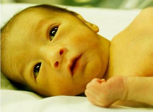 吃什么去胎毒黄疸最有效,初生儿去黄疸的药