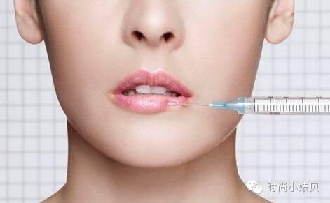 玻尿酸丰唇心得,丰唇失败了如何化妆拯救