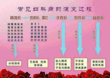 妇科宫颈炎是什么原因引起的,妇科炎症宫颈炎的症状及治疗
