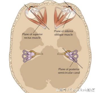 防止孩子晕车的小窍门,防小孩晕车小窍门
