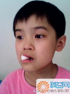 拔牙后发烧是怎么回事如何处理,拔牙后发烧疼痛怎么缓解