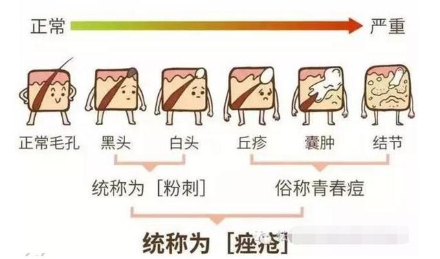 60岁脸上长粉刺,清脸上粉刺的视频