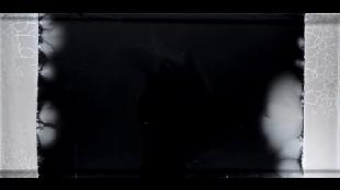 超级细菌1完整版视频,超级细菌入侵人体