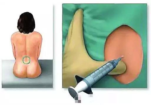 图文并茂：宝妈如何缓解分娩带来的疼痛？