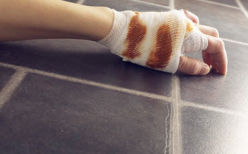 化疗药外渗的处理方法,化疗科普类视频