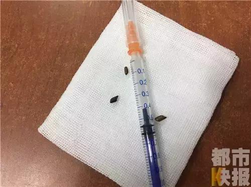 西安：男童游乐园遭意外三粒决明子进入耳中