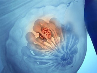 乳腺癌术后内分泌治疗药物的价格,乳腺癌术后内分泌治疗最新方案