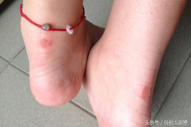 家里鞋子太臭怎么去除,家里鞋子顽固污渍怎么去