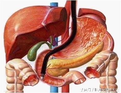 乔布斯胰腺癌得了几年,乔布斯得了胰腺癌活了八年