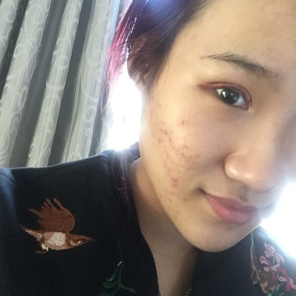 爸爸是直男癌，我割了双眼皮都不让抱了！