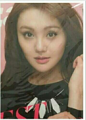 整容后遗症眼眨嘴歪,整容后遗症脸歪鼻子歪