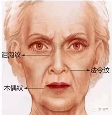 爱笑的女孩法令纹都很深,爱笑的女孩法令纹都不会太差