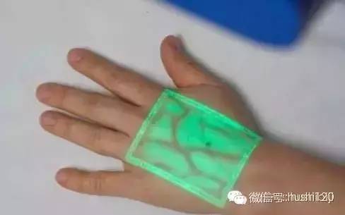 如何扎针不痛,怎么扎针才能不疼