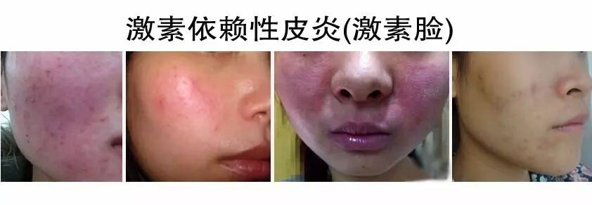 微商的护肤品是骗人的吗,微商化妆品真的靠谱吗