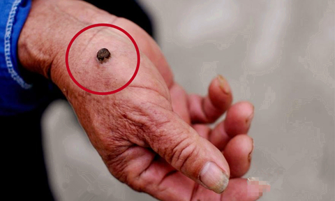 这些症状你都知道吗医学科普,这些症状或许是癌的征兆英语翻译