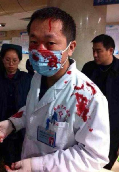 盘点单身狗的痛苦,单身狗最孤独的事