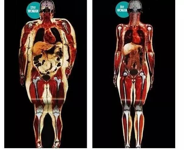 内脏脂肪怎么减男生,内脏脂肪怎么减吃什么药