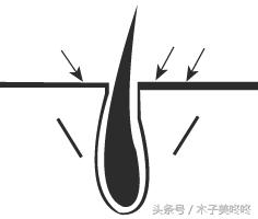 一次性脱毛和永久性脱毛的区别,冰点脱毛真的能永久性脱毛吗