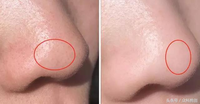 火山泥真的能清洁毛孔吗,用火山泥洗脸再用洗面奶