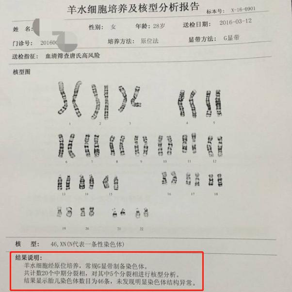 唐筛什么情况下需要做羊水穿刺,唐筛过了有必要做羊水穿刺吗