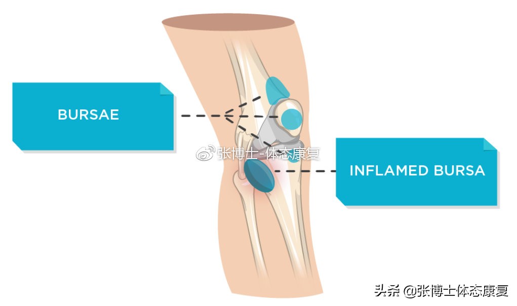 【运动康复科普】为什么你的膝关节内侧会出现疼痛？