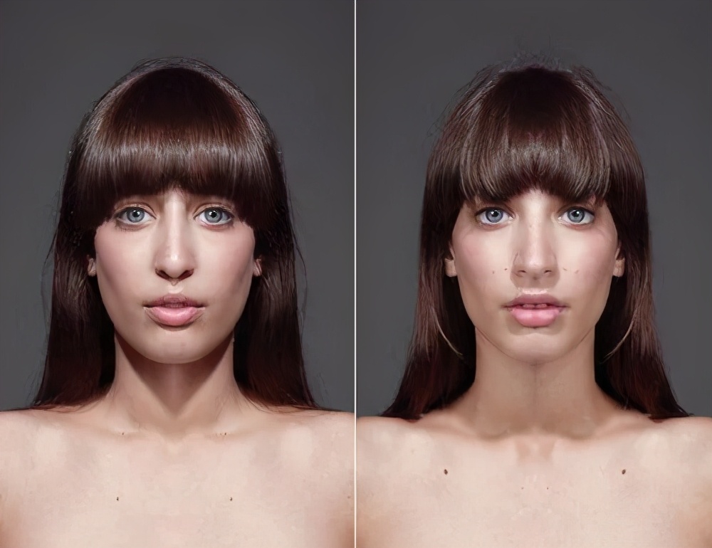 咀嚼导致的大小脸怎么恢复,单侧咀嚼大小脸可以恢复吗