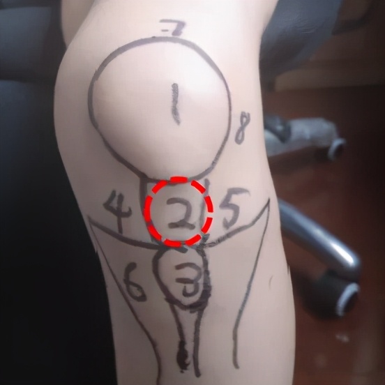 不同部位膝关节,骨科医生教你一招搞定膝盖痛