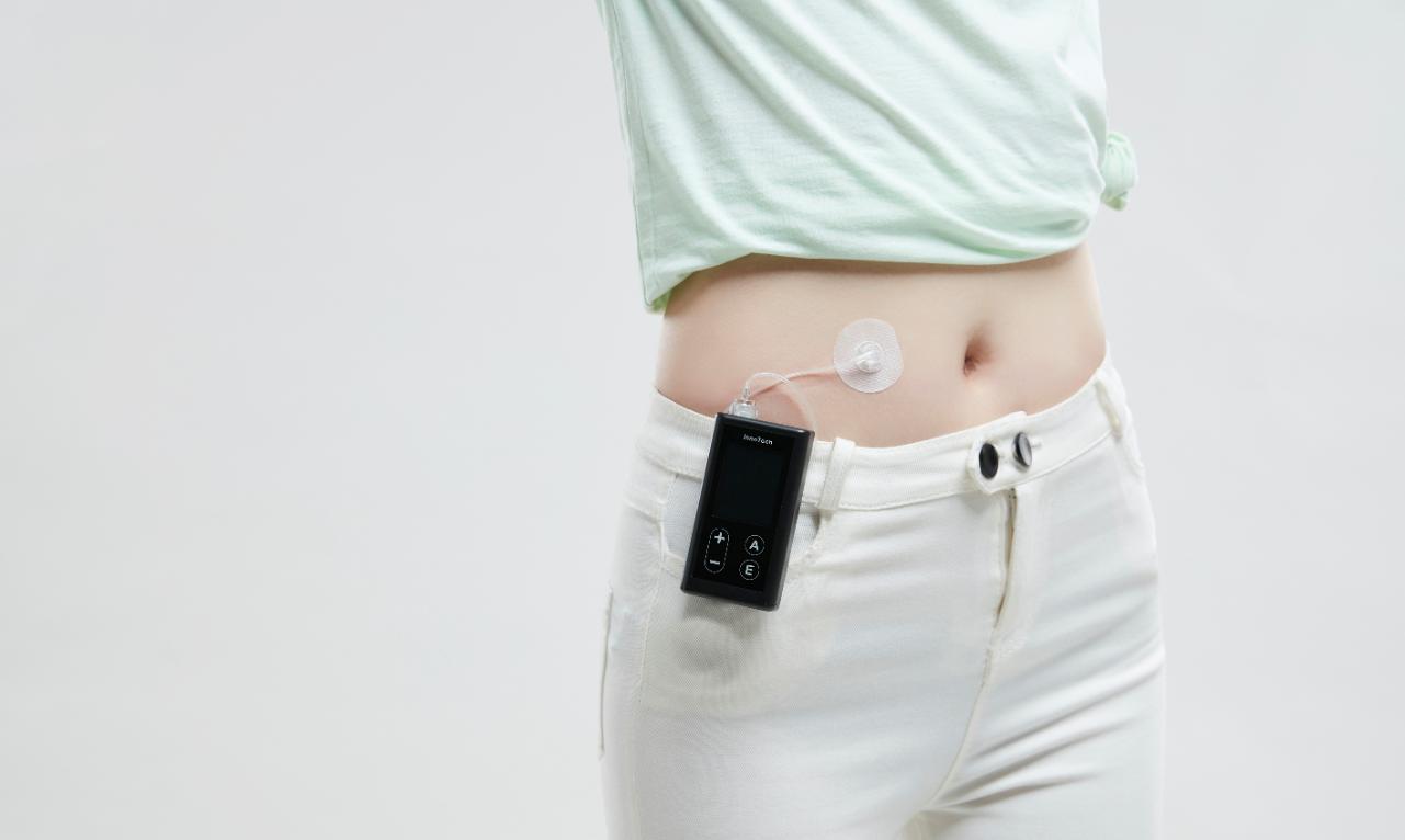 胰岛素泵可以在哪里购买,胰岛素泵的使用方法及注意事项