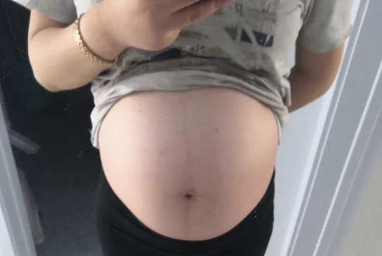 一开始胎心胎芽正常后来没有了,胎心迟迟不出现会造成胎芽萎缩吗