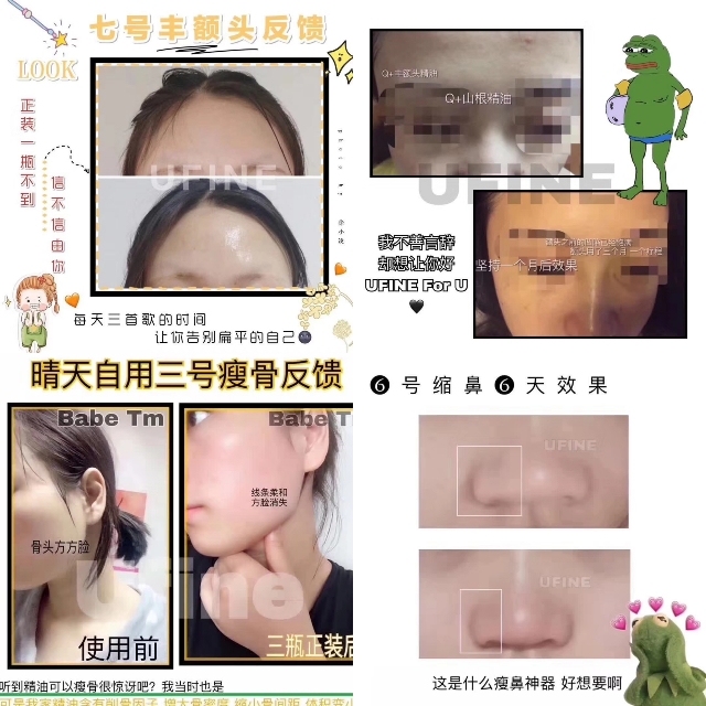 小黑瓶真的有整容的效果吗,揭秘小黑瓶骗局