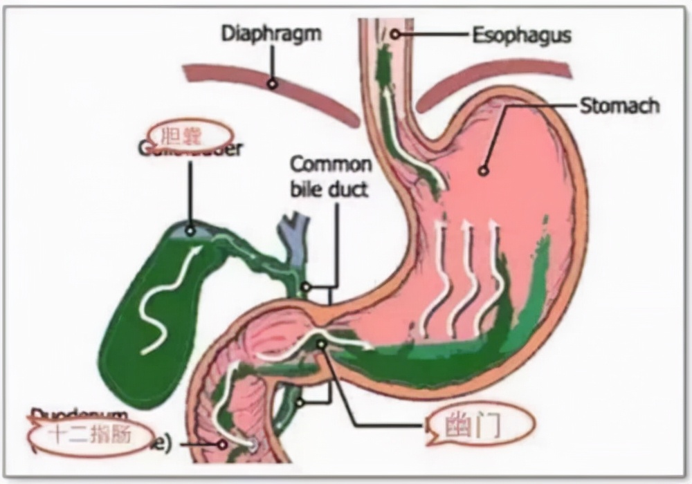萎缩性胃炎吃羔羊胃还会癌变吗,萎缩性胃炎是胃缩小了吗