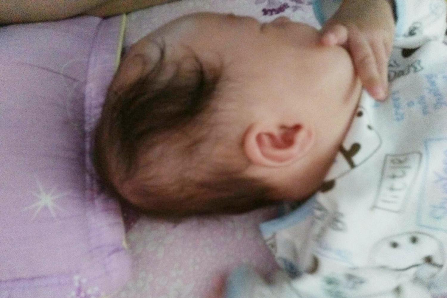 新生儿头型偏长如何睡圆,青年扁头可以通过睡姿矫正吗